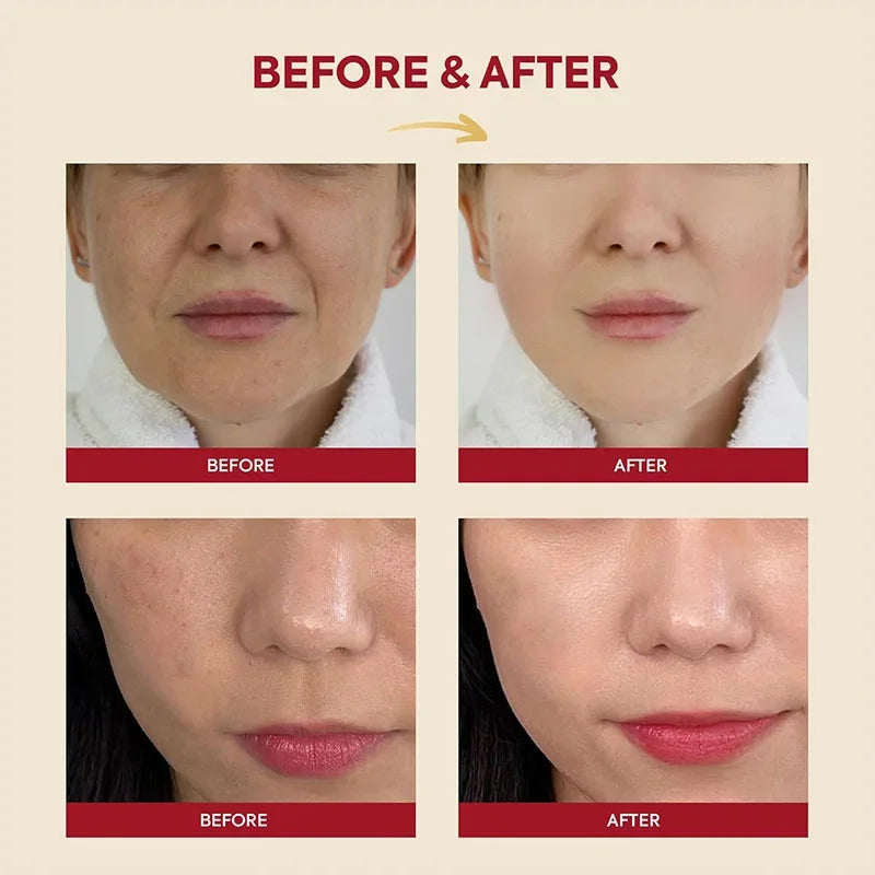 Korean Brand Skin Care Set Seoul 1988 Anti-aging Brightening Eye Cream Sunscreen Anti-wrinkle Essence Rice Cream Essence Water