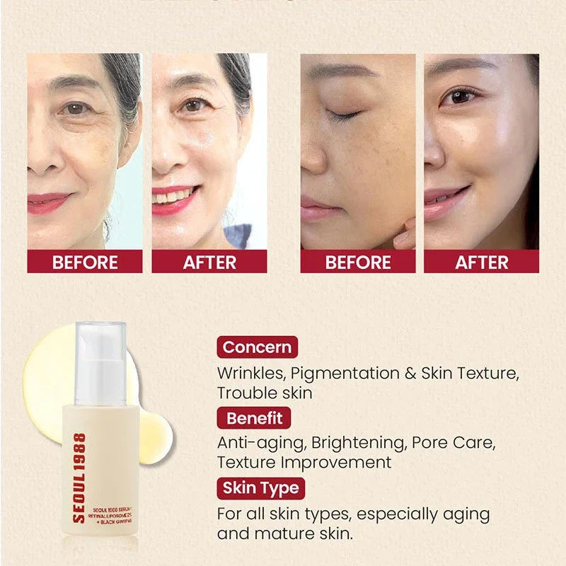 Korean Brand Skin Care Set Seoul 1988 Anti-aging Brightening Eye Cream Sunscreen Anti-wrinkle Essence Rice Cream Essence Water